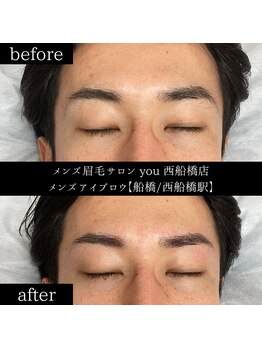 ユー 西船橋店(you)/ビフォーアフター写真