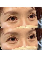 ラヴィズム アイラッシュ アンド ネイル (LUVISM)/マツエク★ 担当:川崎