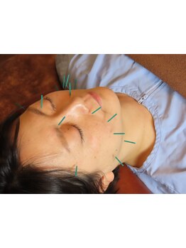 小顔になりたい