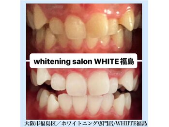 ホワイトニングサロン ホワイト(WHITE)/セルフホワイトニング/大阪/福島