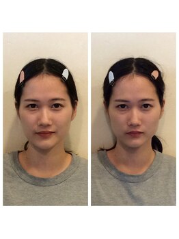 健幸堂 本店/小顔矯正1回