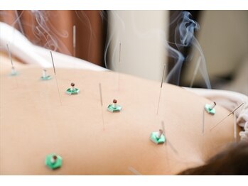 メイク(Make)/髪の毛ほどの細い鍼でツボを刺激