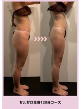 バベルトータルビューティー 北堀江店(Babel Total Beauty)/全身コース〈Before/After〉