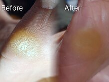 エンネイル(en.nail)/70代女性