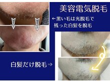 イルブル(il blu)の雰囲気（美容電気脱毛★白髪・眉毛・硬毛化も◎毛1本１本にアプローチ）