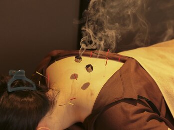 森の鍼灸院 京都下京町家院/灸頭鍼