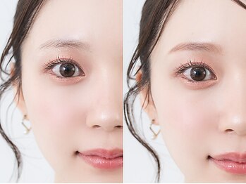 ビジュー(Bijou)の写真/初めてでも安心♪【HBL公式認定サロン】豊富なクーポンで美眉＆シェービングで垢抜け＆ツヤ肌へ♪