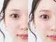 ビジュー(Bijou)の写真/初めてでも安心♪【HBL公式認定サロン】豊富なクーポンで美眉＆シェービングで垢抜け＆ツヤ肌へ♪