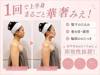 韓国小顔コルギ＆肌管理専門【SONU:A skin｜ソヌア】沖縄店/小顔コルギの写真