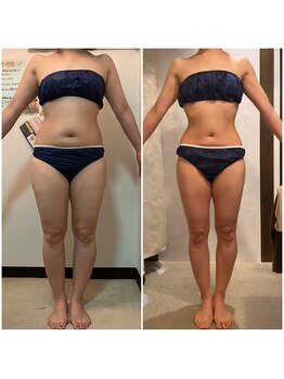 骨盤ストレッチ整体 b/ハイパーナイフ＋骨盤矯正