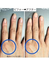 桃の木 吉祥寺店/ネイルケアで手も明るくなります