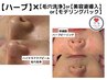 【ニキビ徹底ケア】ハーブ＋毛穴洗浄or美容液導入orモデリングパック¥12,600