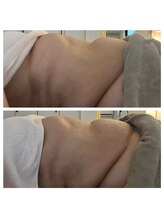 美温(mion)/代謝アップ　お腹