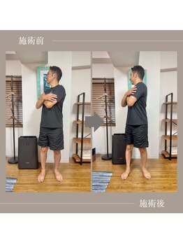 バレルメディカル研究所 恵比寿/何とか歩いて帰れるように。