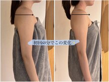 ポノ インディバ サロン(pono. Indiba salon)/初回60分で巻き肩/姿勢改善！！