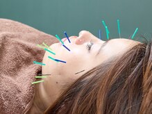 ハリトマト 梅田中崎/施術（肌荒れ・ツヤ）