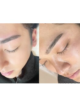 メンズフェイシャル