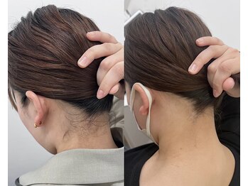 ミース 京都駅前店/うなじビフォーアフター