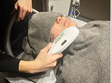 ヒゲ脱毛☆毎日の髭剃りから解放！肌荒れを防ぎ清潔感のある肌へ