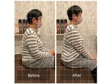 トラスト整体院 小池院/60代/女性/パート/手の痺れ