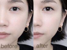 エーワイラッシュ 藤沢店(AYLASH)/フラットラッシュ☆