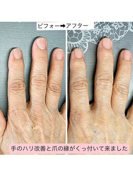 ハンドケアは結果が出やすい