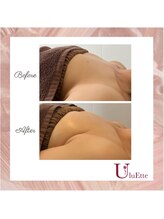 ウルエッテ(UluEtte)/横になっても綺麗なバスト/天神