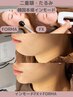 【日本初上陸】韓国本場のインモード◆FX+FORMA