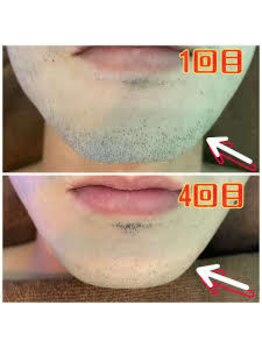 ヴィシア(VIXIA)/お客様のビフォーアフターご紹介