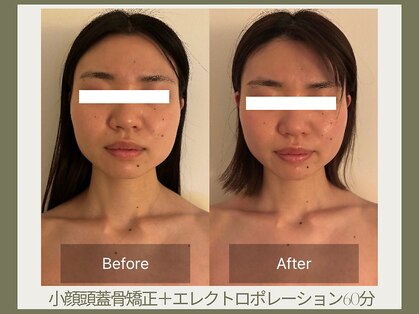 フェイシア 渋谷店(facia)の写真