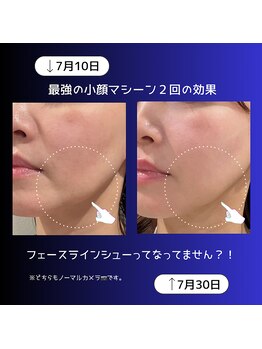 リオル(Rior)/2025年最強の小顔ケア