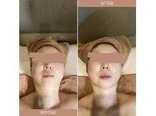 ヘルシーアンドビューティー でわの雰囲気( その場で小顔。顔が変わる。初体験の技術で戻らない小顔体験。)