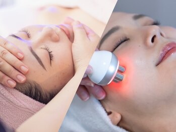 ビューティースタジオ エイワン(A1)の写真/【速攻小顔☆圧倒的効果】切らないリフトアップ！熟練の手技×多機能マシンで術後に驚き！小顔矯正￥9980