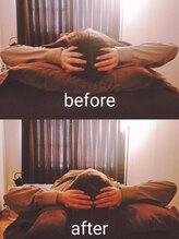 エスプリクレール(Esprit Clair)/【札幌】頭蓋骨小顔セラピー