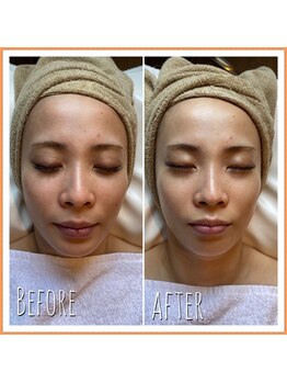 レアリゼ(Realiser)/フォーエバーヤング