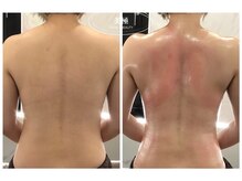 美極 銀座店/銀座/小顔コルギ/小顔矯正