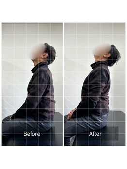 ナオル整体 大塚院(NAORU整体)/50代男性施術事例【猫背矯正】