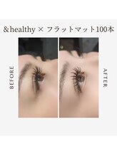 シェール(cher)/＆healthy