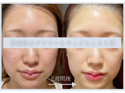 ビボーラ(BEBEAURA)の写真