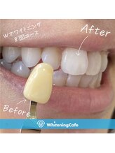 ホワイトニングカフェ 千葉店/ホワイトニングビフォーアフター