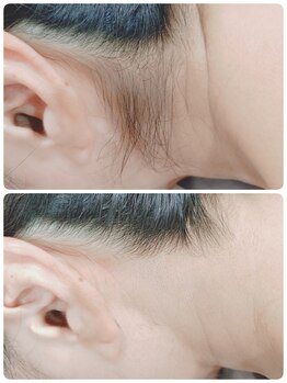 エタニティ 西宮店(Eternity)/うなじ、背中/成人式/ブライダル