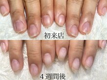 ココモ(cocomo)/(深爪/長さだし/フィルイン)