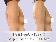 ベルペール(Belle perle)/【痩身/バスト】ハンドセラピス