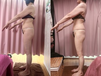 美容整体カラダリメイク(karada)/骨盤矯正ダイエットの結果