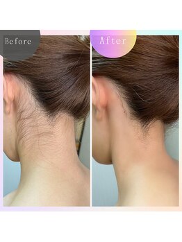 ビューティーサロン カーメル八王子店/【ブライダル】シェービング♪