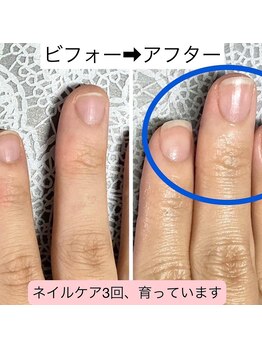 桃の木 吉祥寺店/小さな爪は生まれつき?