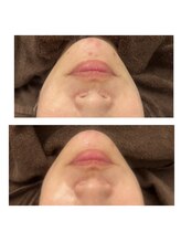 ヴィヴ コレビ(VIV COREBI)/一度で赤いポツポツが♪