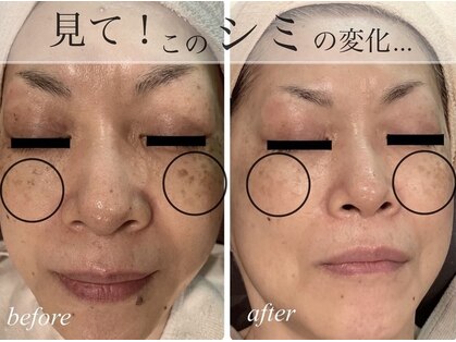 ビーフリー(Be free)の写真