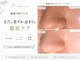 スリー(three)の写真