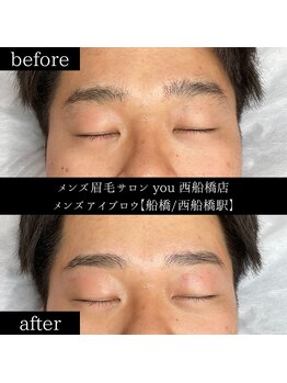 ユー 西船橋店(you)/ビフォーアフター写真